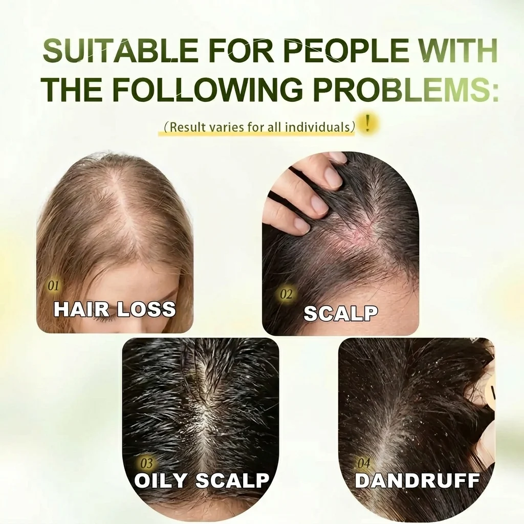 ⚡ Visible Results in 7 Days | The Thinner Your Hair, the Better It Works