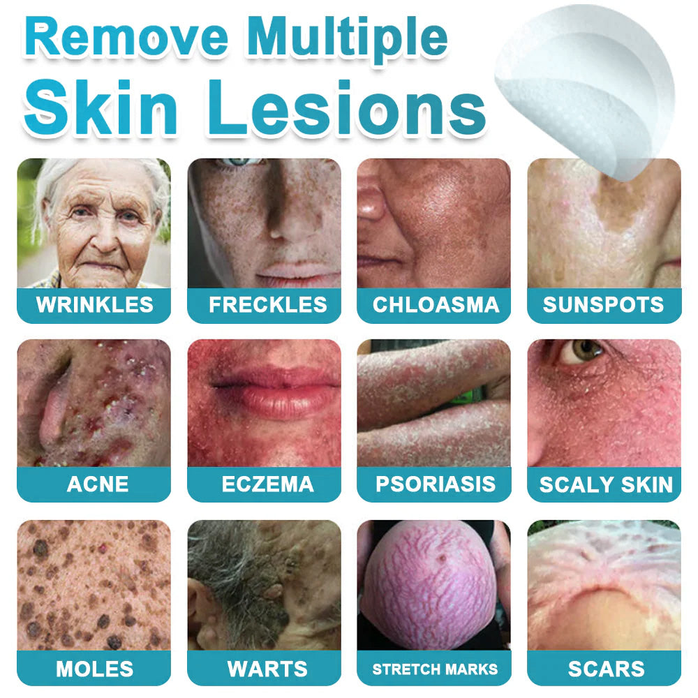 Hiskin ® 2-in-1 Microneedle & Hydrocolloid Patch👨‍⚕️ | Removes raised moles, acne, flat warts, and skin tags | Helps improve wrinkles, scars, and blemishes | Invisible patches for face and body💖