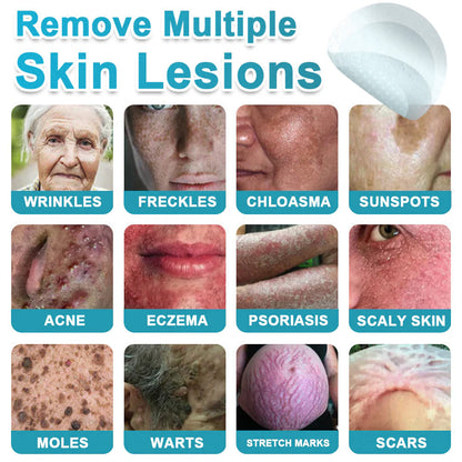 Hiskin ® 2-in-1 Microneedle & Hydrocolloid Patch👨‍⚕️ | Removes raised moles, acne, flat warts, and skin tags | Helps improve wrinkles, scars, and blemishes | Invisible patches for face and body💖