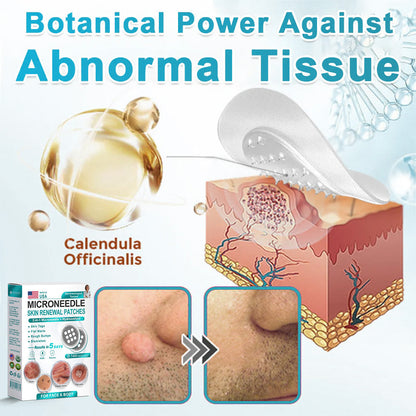 Hiskin ® 2-in-1 Microneedle & Hydrocolloid Patch👨‍⚕️ | Removes raised moles, acne, flat warts, and skin tags | Helps improve wrinkles, scars, and blemishes | Invisible patches for face and body💖