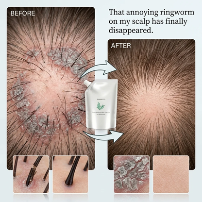 ⚡ Visible Results in 7 Days | The Thinner Your Hair, the Better It Works