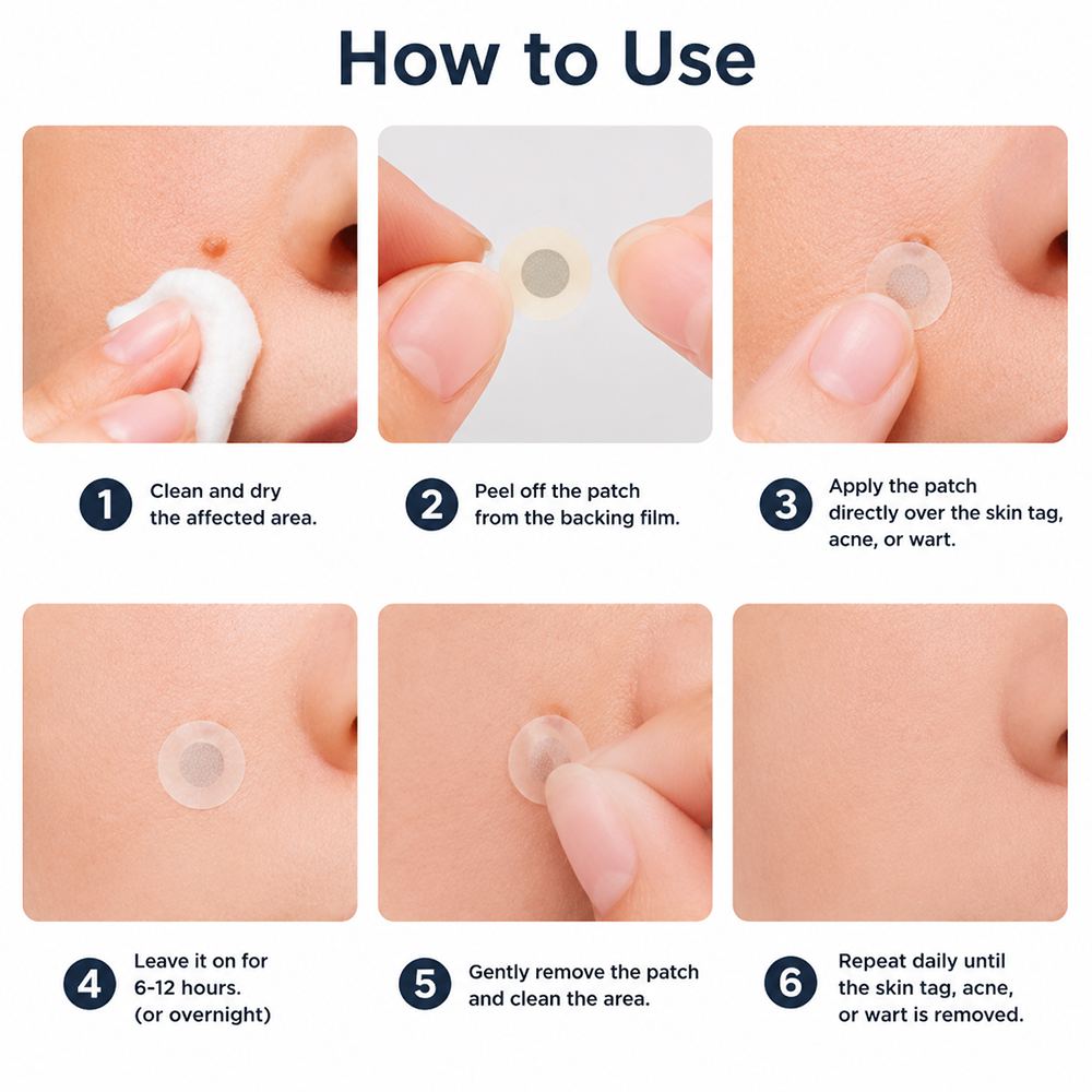 Hiskin ® 2-in-1 Microneedle & Hydrocolloid Patch👨‍⚕️ | Removes raised moles, acne, flat warts, and skin tags | Helps improve wrinkles, scars, and blemishes | Invisible patches for face and body💖