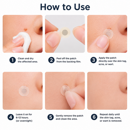 Hiskin ® 2-in-1 Microneedle & Hydrocolloid Patch👨‍⚕️ | Removes raised moles, acne, flat warts, and skin tags | Helps improve wrinkles, scars, and blemishes | Invisible patches for face and body💖