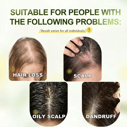 ⚡ Visible Results in 7 Days | The Thinner Your Hair, the Better It Works