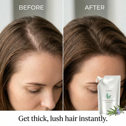 ⚡ Visible Results in 7 Days | The Thinner Your Hair, the Better It Works